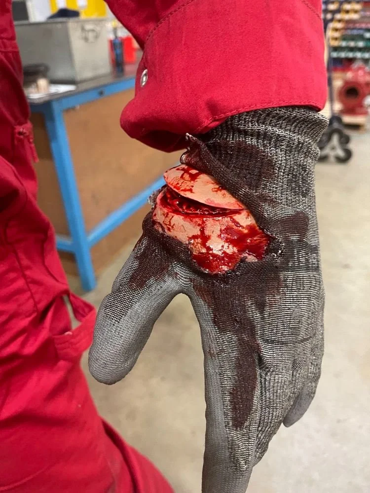 Angle grinder injury for casualty training video