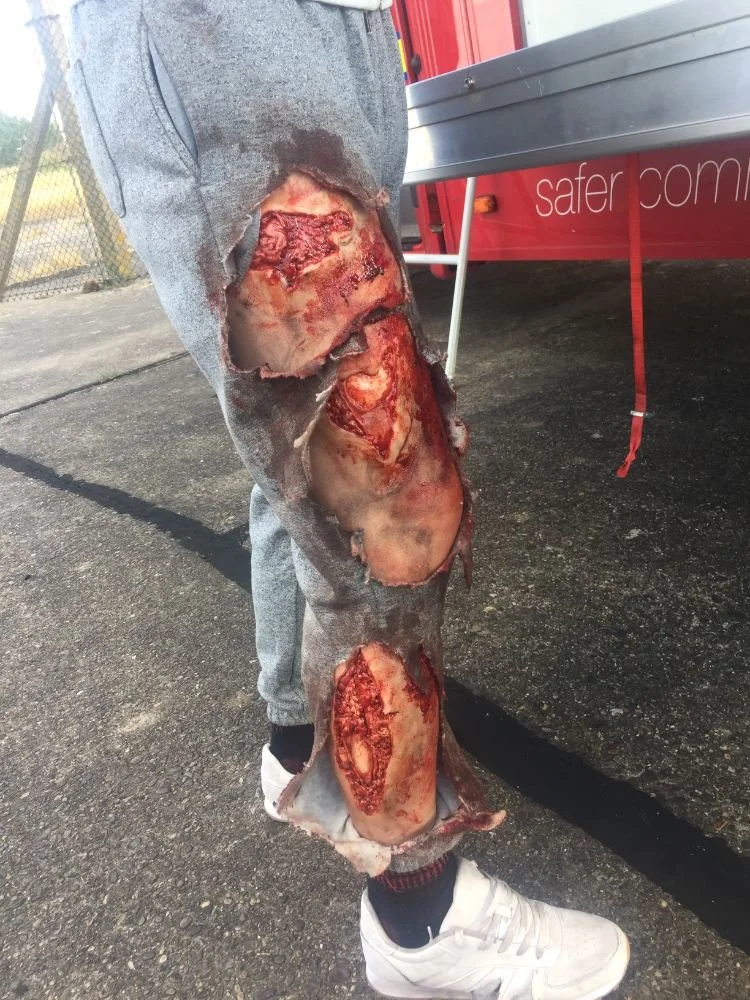 Motorcycle injury prosthetics for training video