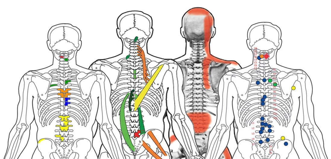 Difference Between Spinal Reflex Analysis and Spinal Reflex Therapy