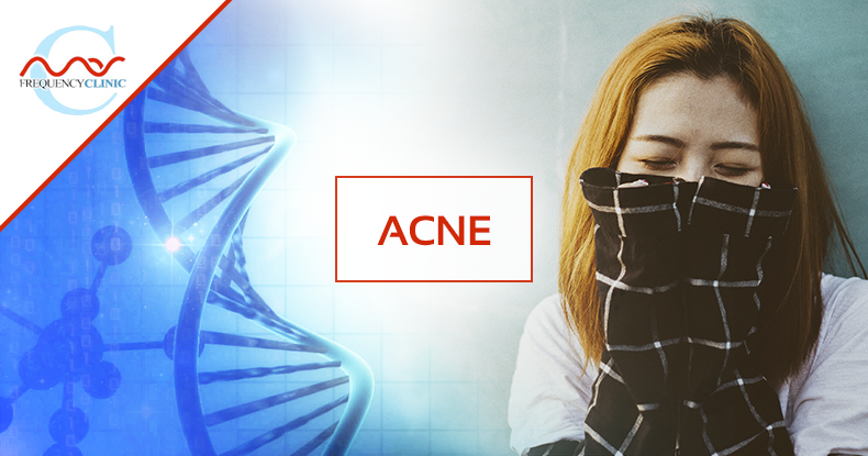 mas-sajady-program-reviews-frequency-acne.png
