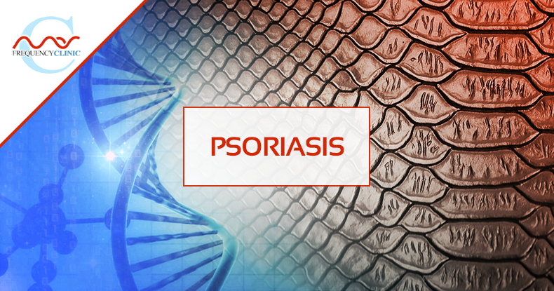 mas-sajady-program-reviews-frequency-psoriasis.png