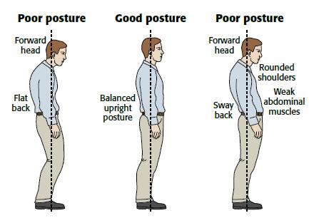 Poor Posture & its Effects on the Body