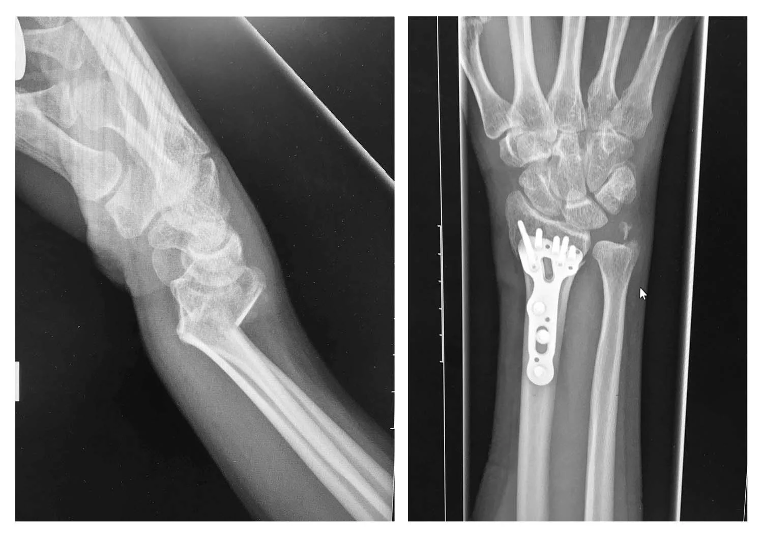 xray.jpg