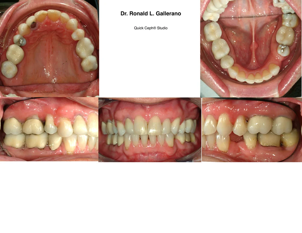 M.D. - After