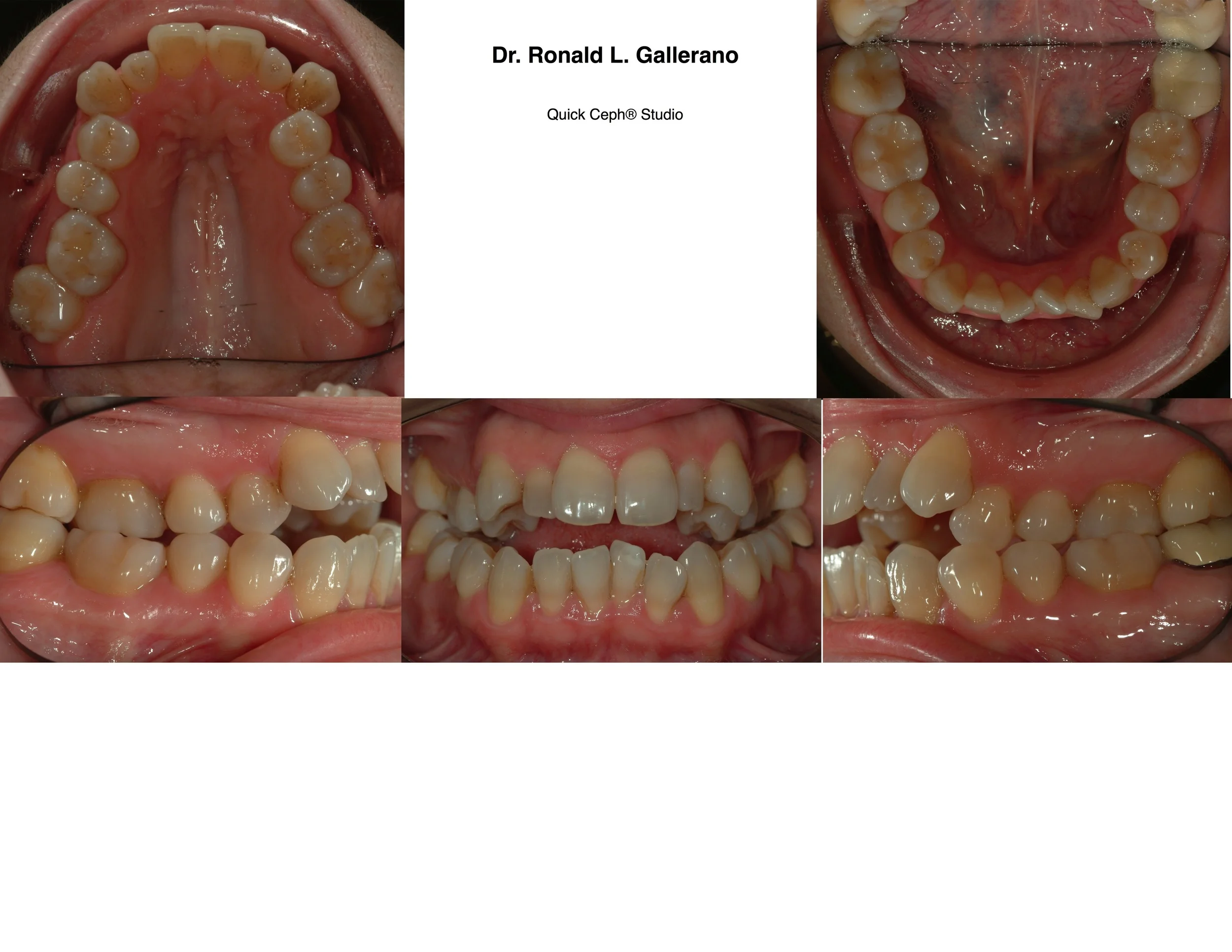 E.R. (42) - Before
