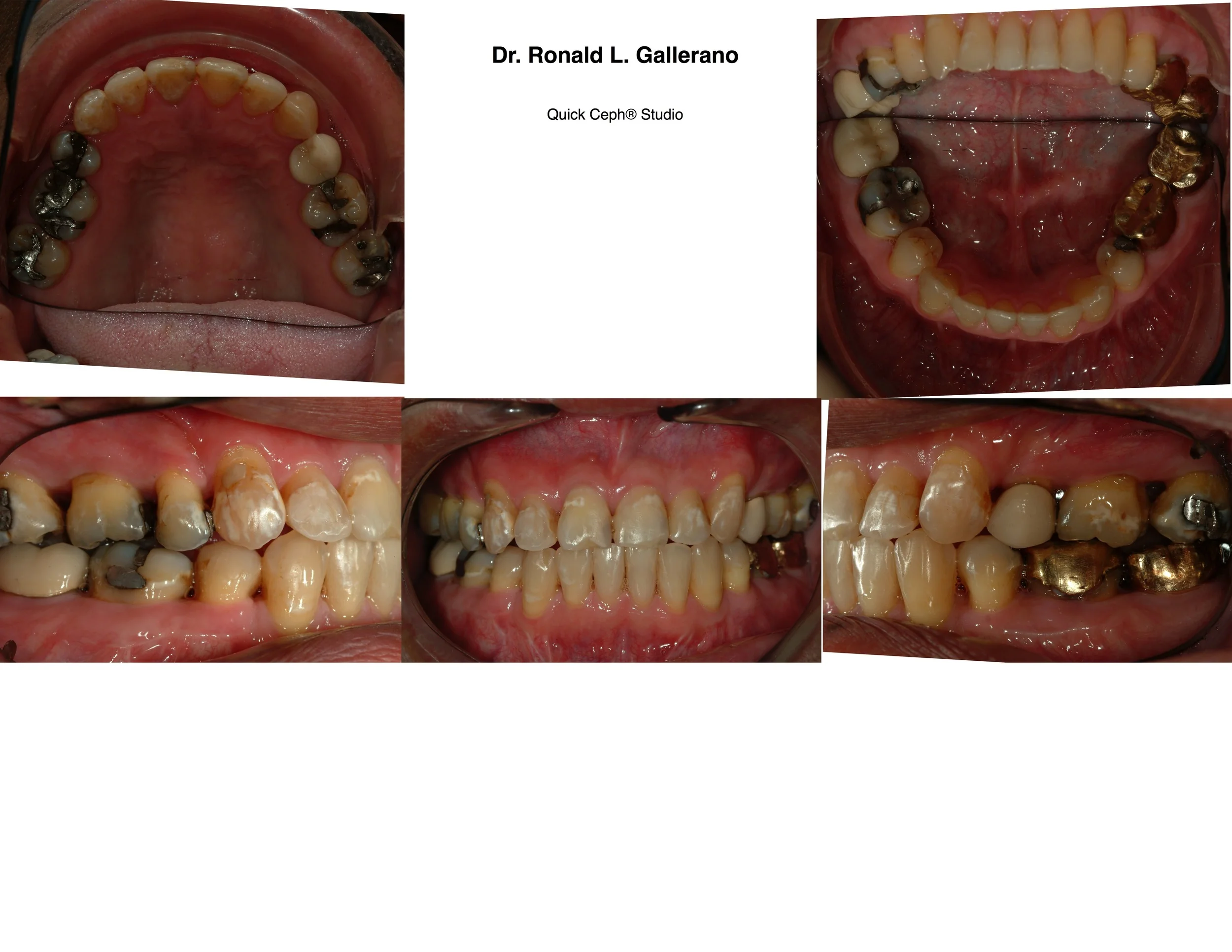 G.S. - After