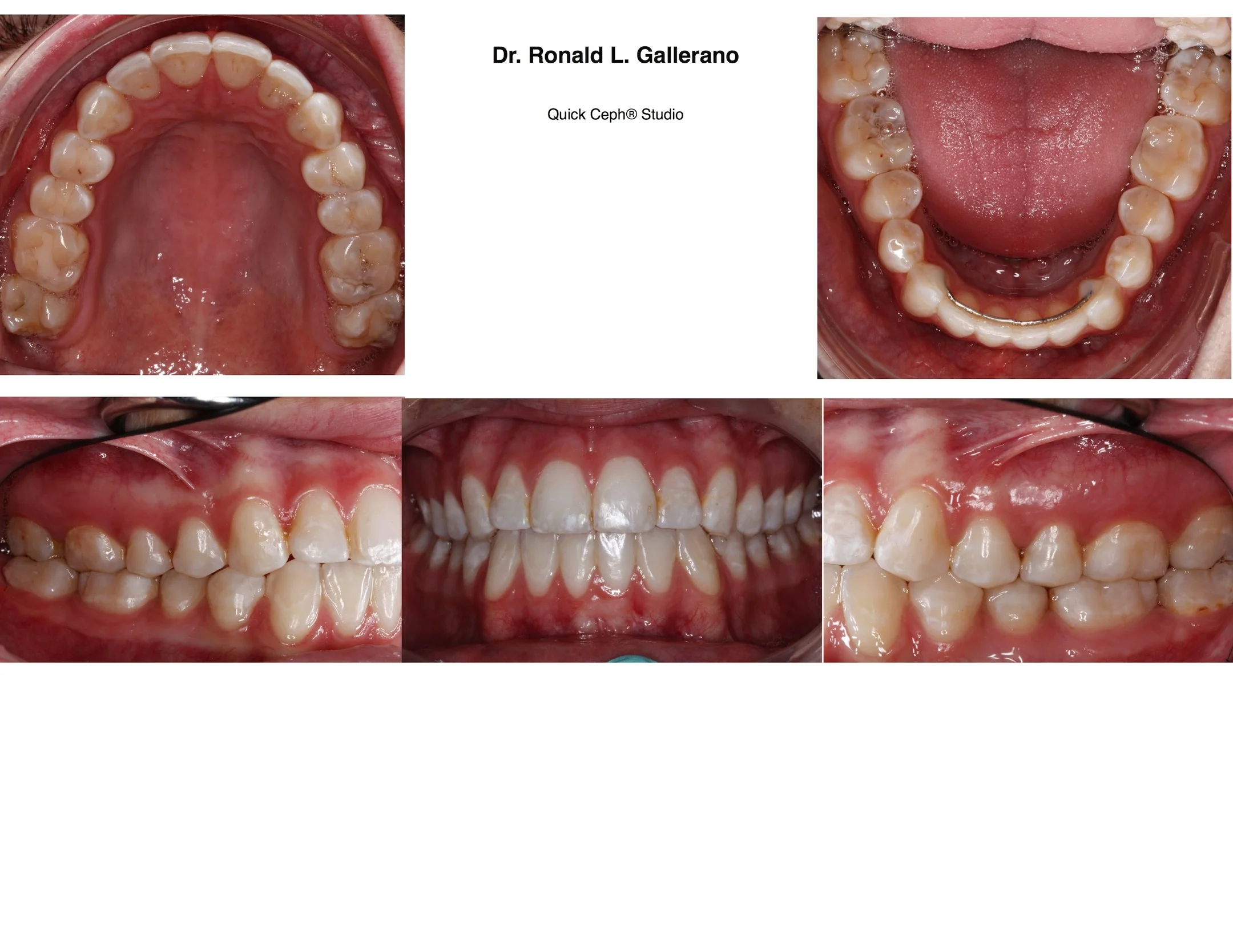 K.C. (20y, 7m) After