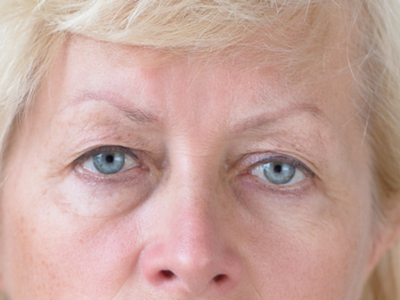 Before Corrective Treatment