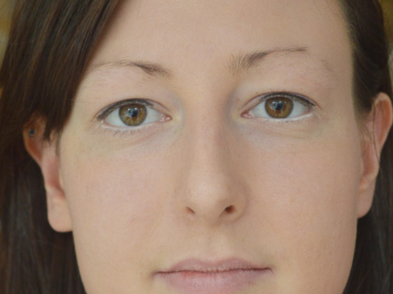 Before Eyebrows