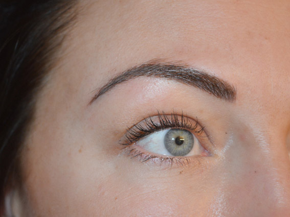 After Eyebrows