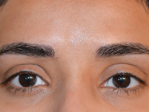 Esteem-Beauty-Semi-Permanent-Makeup-Portfolio-Image85.jpg