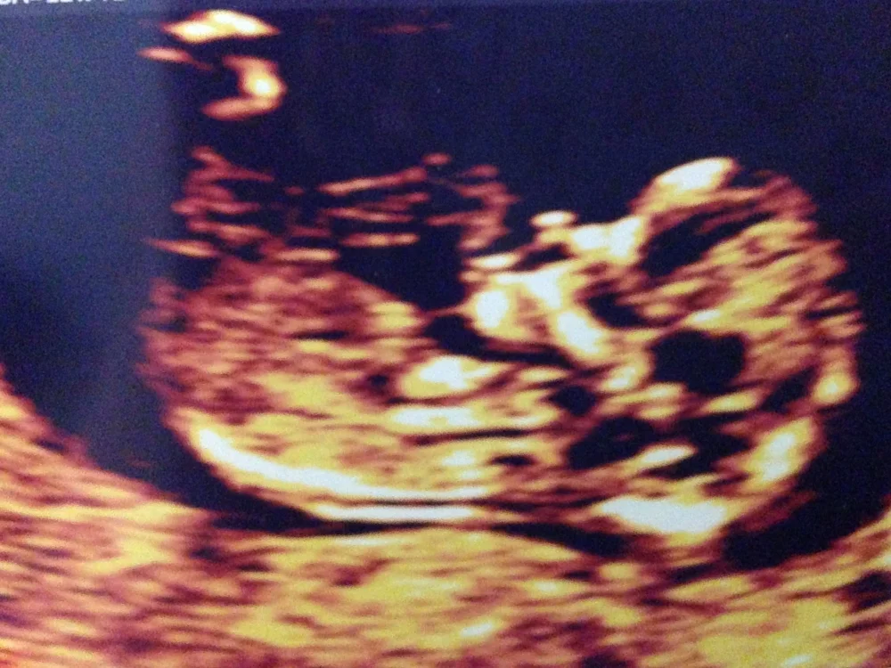 ntscan.jpg