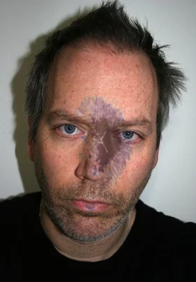 John O'Connor Self Portrait with Sun Spots Photography 13.5" x 19.5"