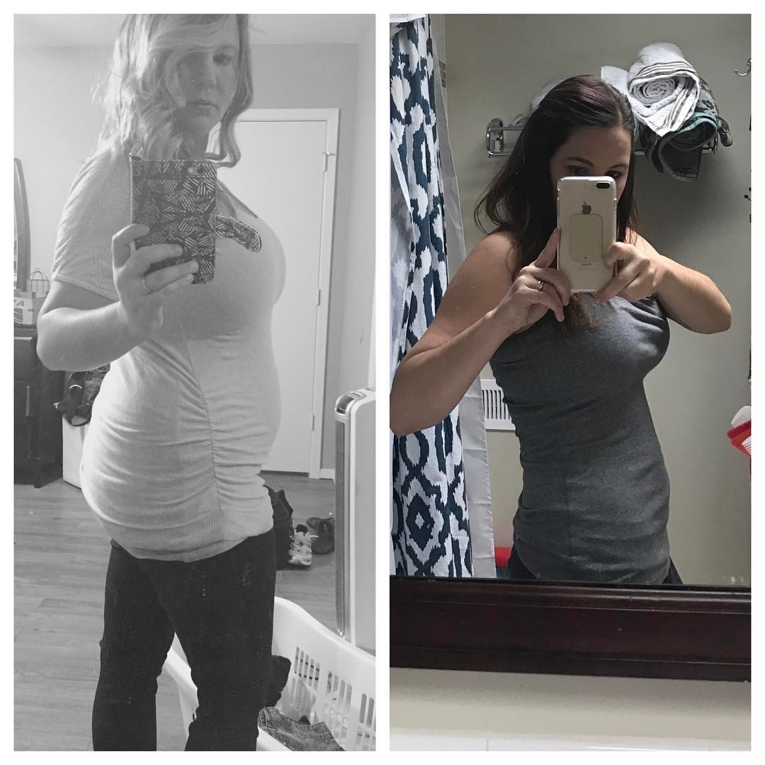 Before&After -KetoGoodness - KristaJuline