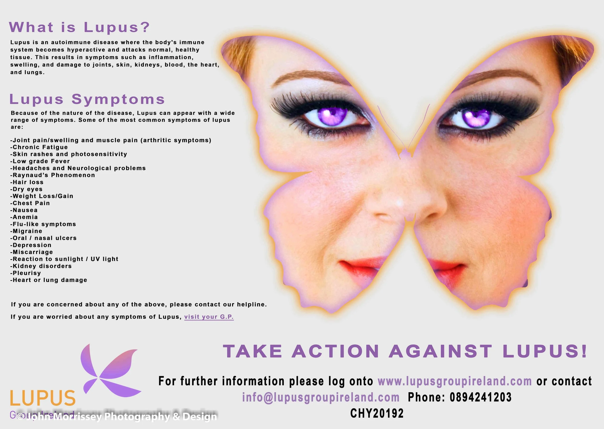 Lupus Group Ireland Poster.