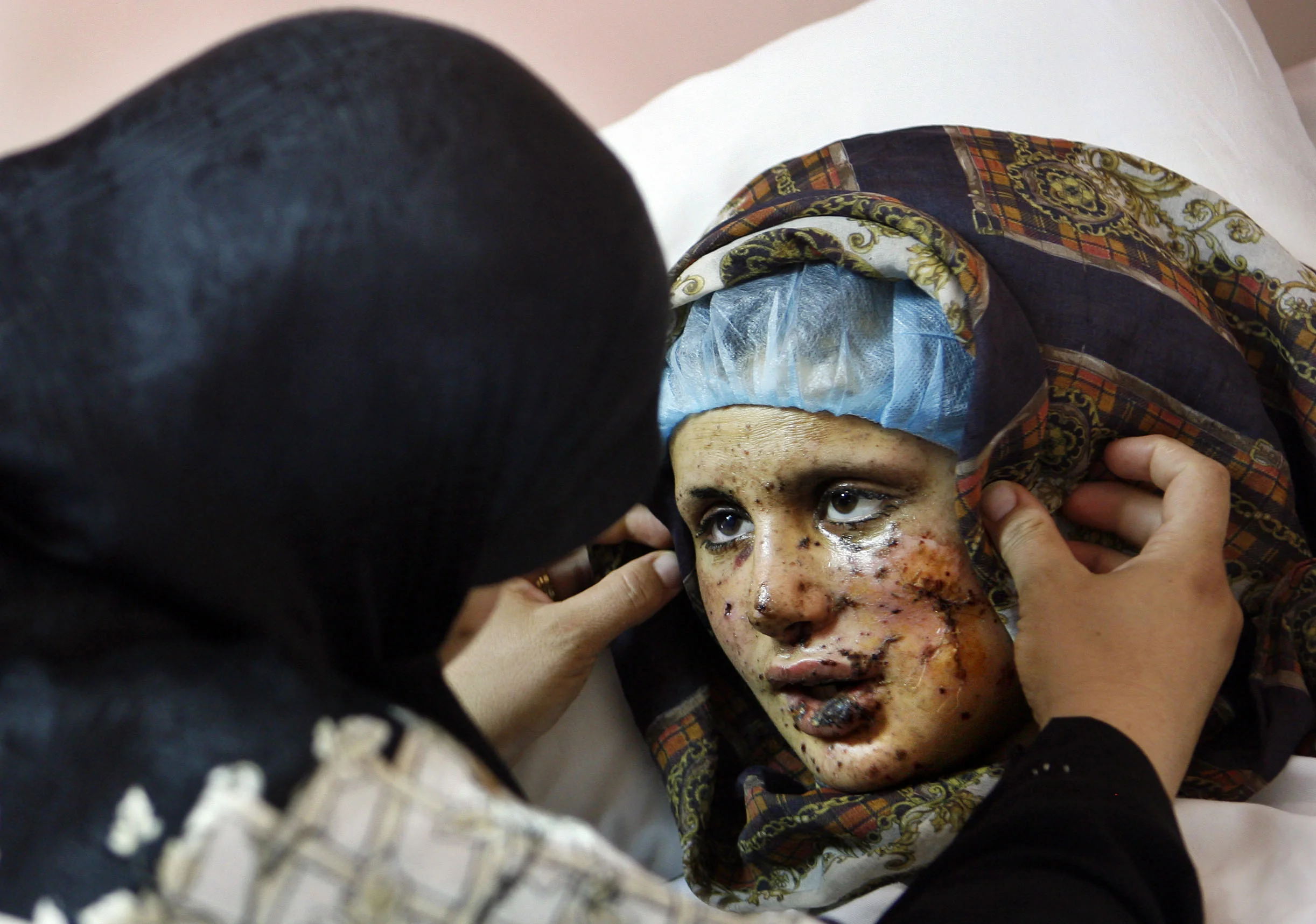 A mother cares for her daughter in hospital in Beirut after she was seriously injured during an Israeli bombardment of the suburb of Dahia, Beirut, July 2006.
