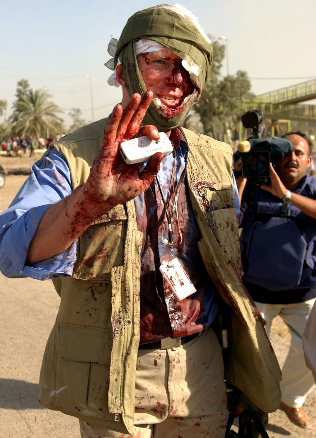 An injured U.N. employee walks away from the destroyed U.N. building in Baghdad, Iraq, following a suicide, truck bomb attack, killing many inside including the head of the mission. Baghdad, August 2003.