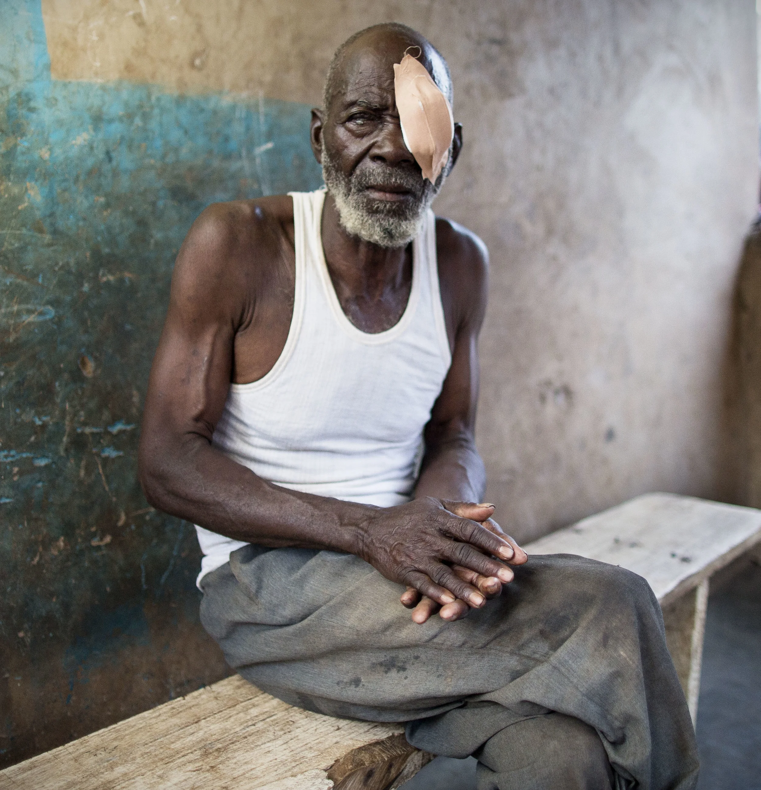Trichiasis patient, Abdul-Rahman Neindow, moments after surgery outside his house in the village of Zuozugu, Ghana. 'Sightsavers' works closely with the Ghanaian health service to combat trachoma. November 2013.