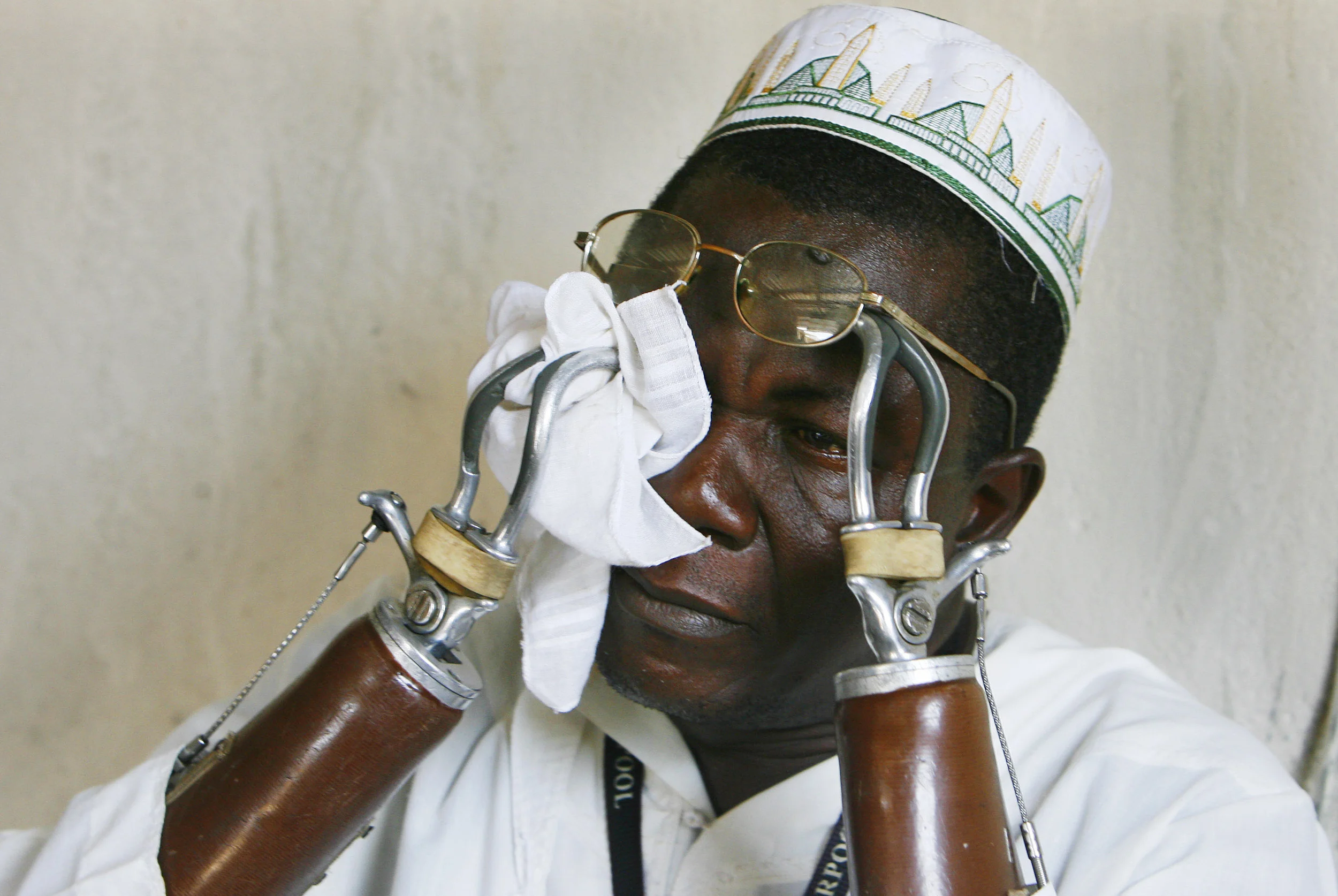 El Haji Lamine Jusu-Jarka, whose hands were chopped off by rebels in Sierra Leone, 1999.