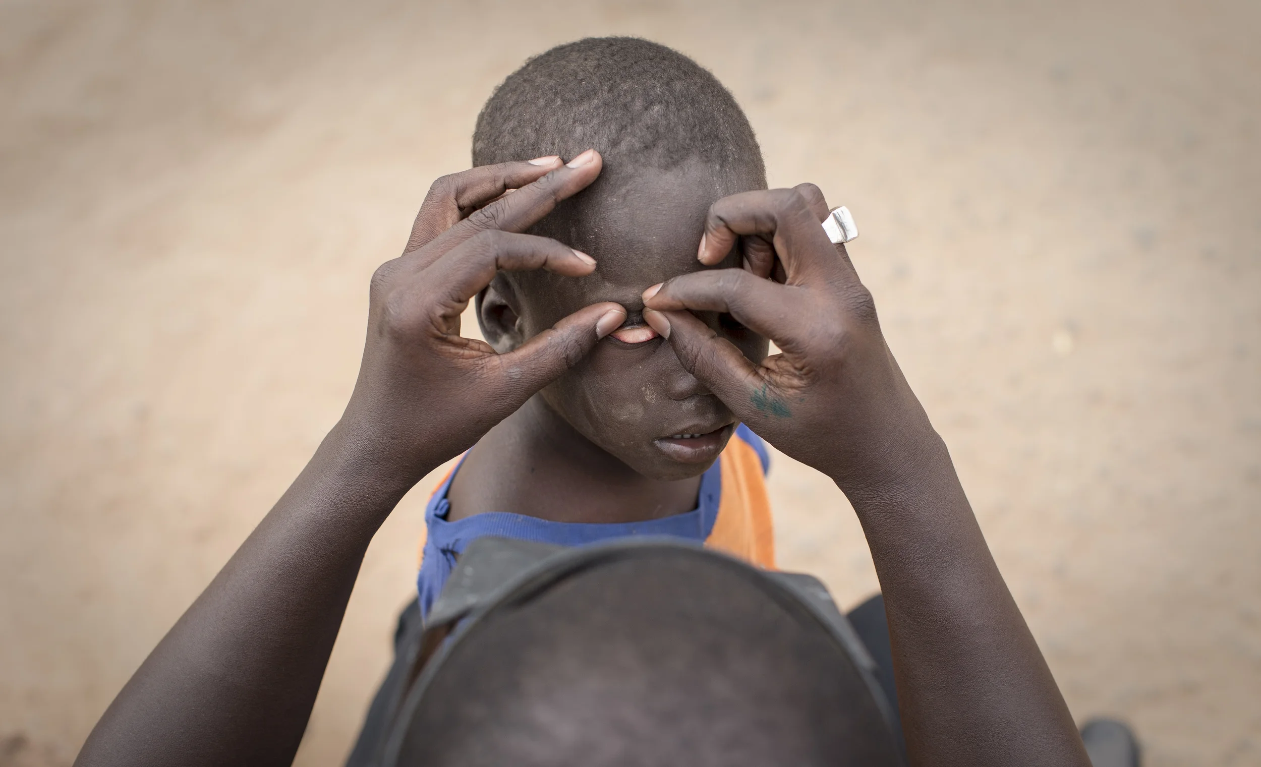  Pape Ndiaye has his eyes checked for the trachoma disease, Kaffrin, Senegal. &nbsp;'Sightsavers'is engaged in programs to combat trachoma. November 2013. 