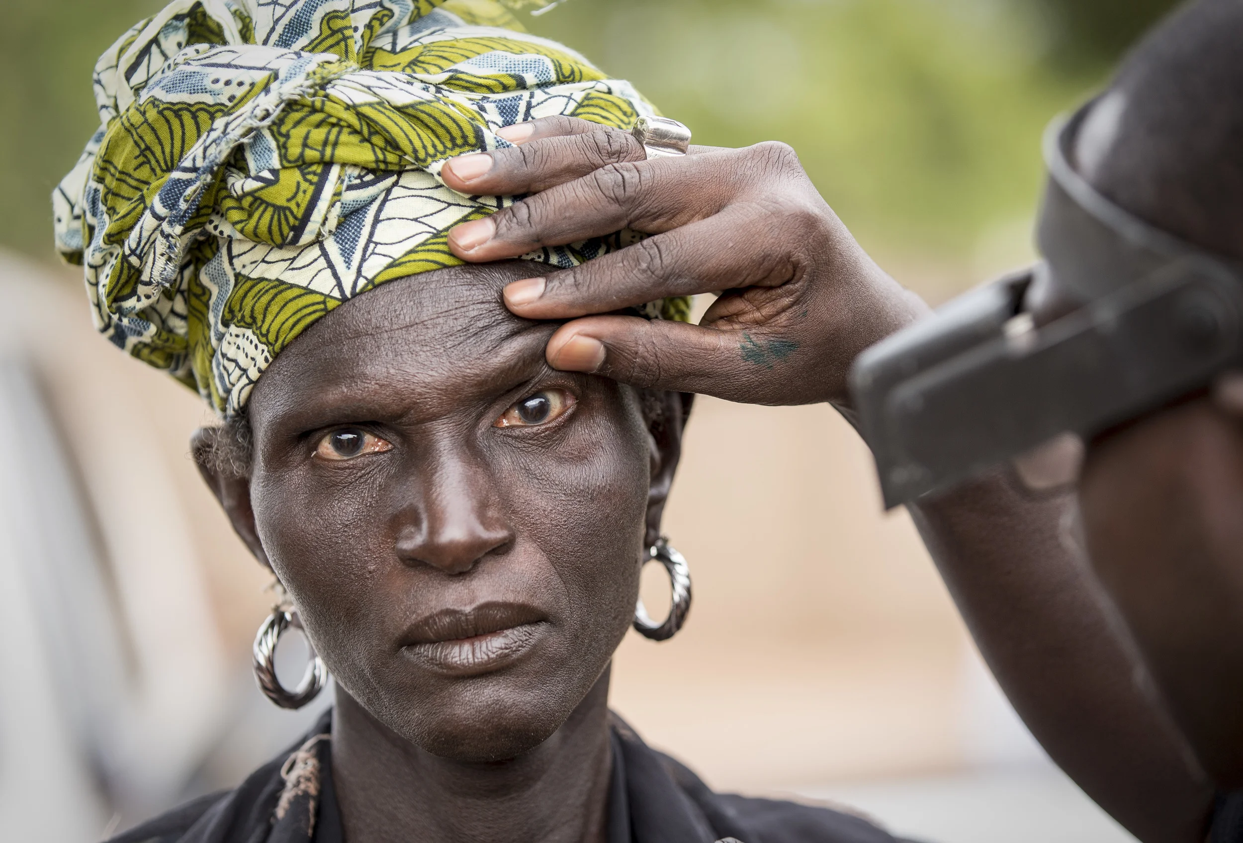  A woman trichiasis patient ahead of her operation. Kaffrin, Senegal, November 2103. 