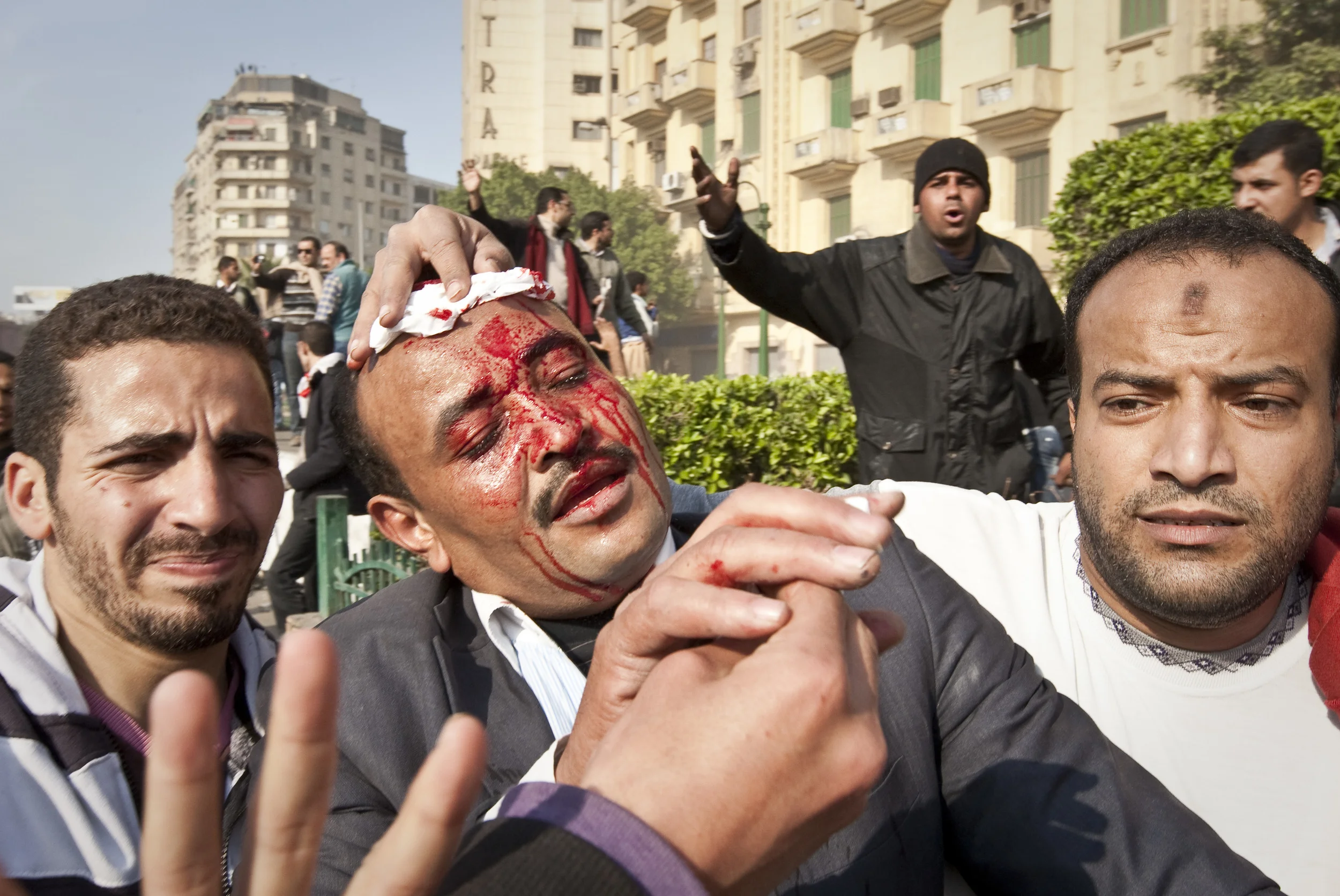  An anti-Mubarak protester, one of the first casualties of rioting in Tahrir square, Cairo, as rival groups fought for control of the area, 2011. 