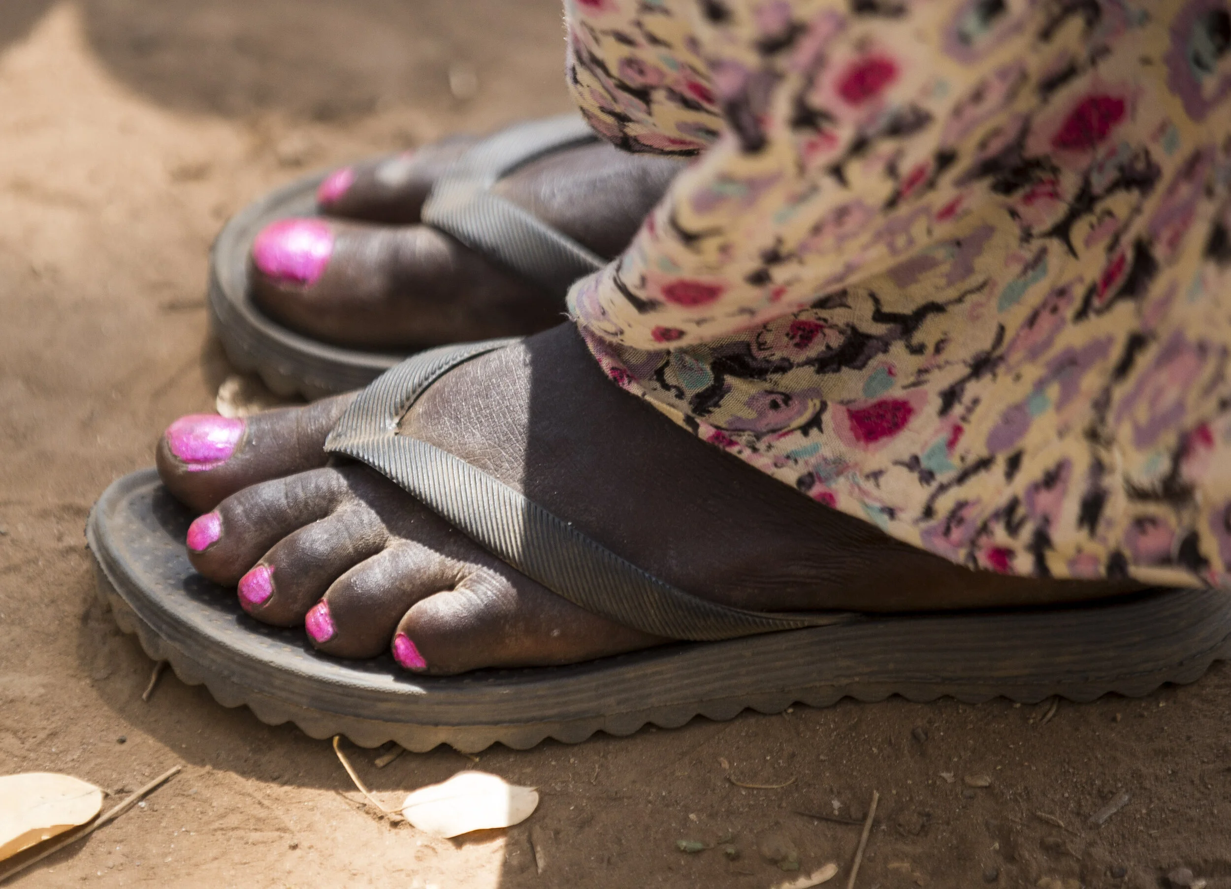  A South Sudanese woman refugee, complete with pink nail varnish on her toes is seen at the Kule refugee camp, in Ethiopia. November 7, 2014 