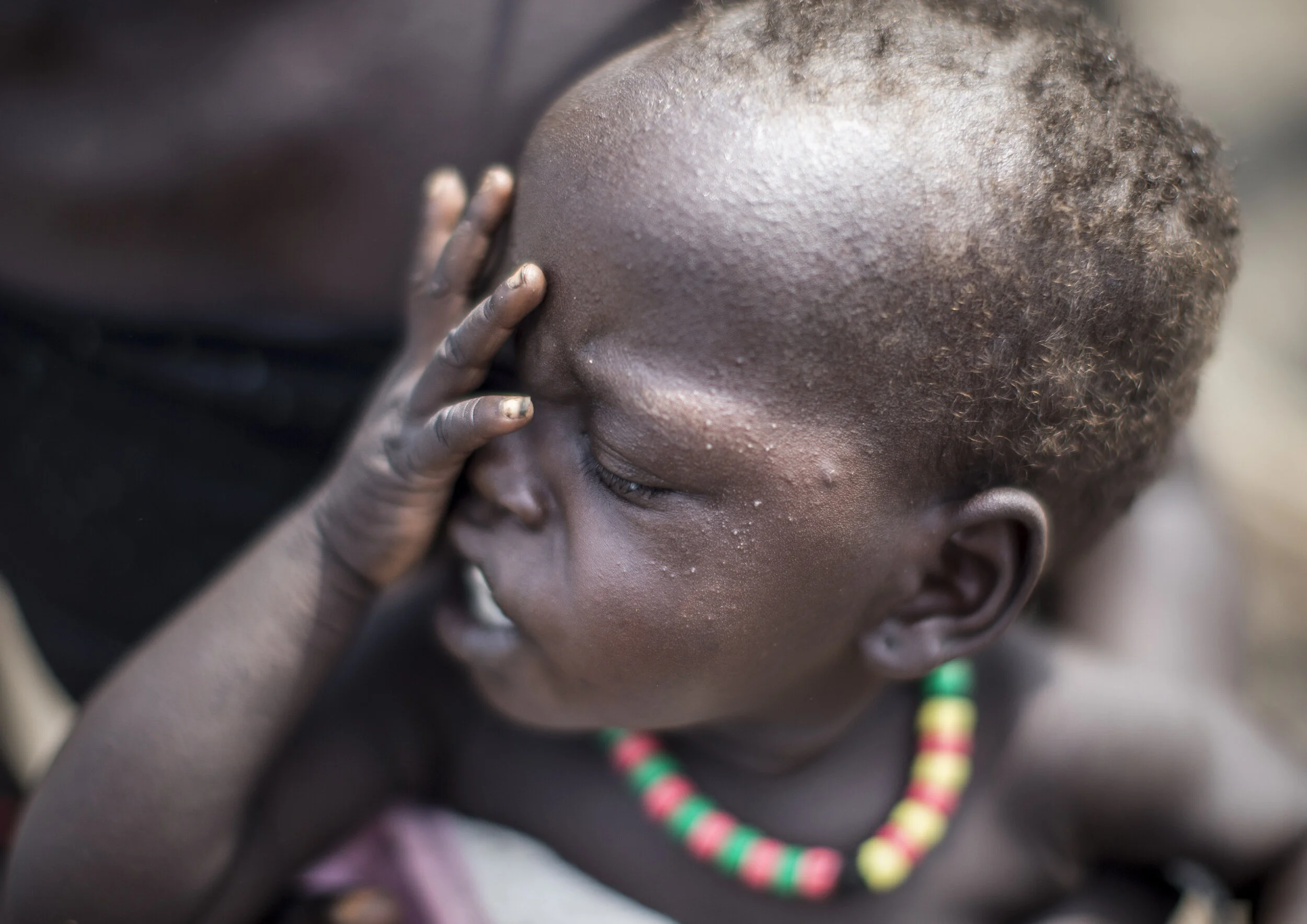  The baby of South Sudanese refugee, Nyabang Yual, 24, at the flooded Leitchour refugee camp in Ethiopia, having fled the worsening internal conflict in their country.  November 7, 2014 