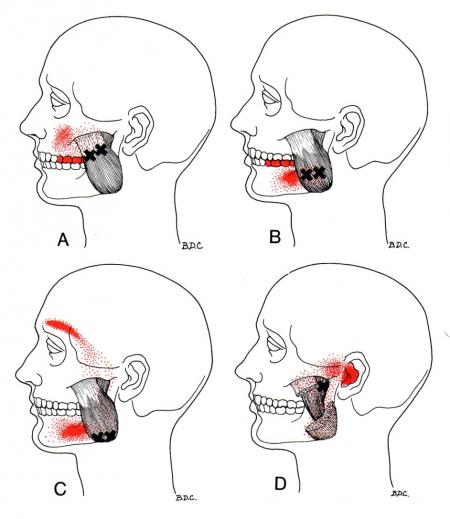 acupuncture_tmj_flatiron.jpeg