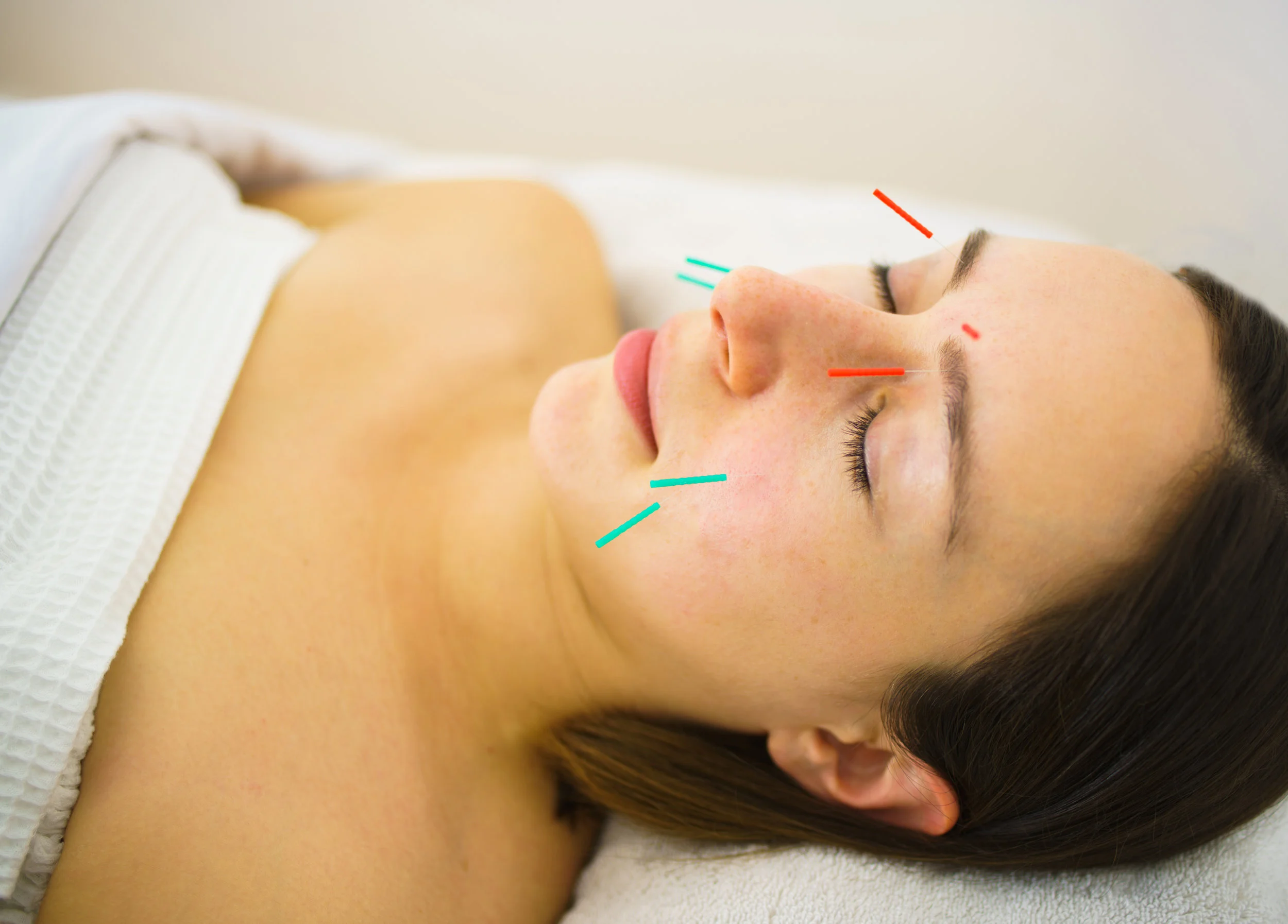 COSMETIC ACUPUNCTURE-NYC.jpg