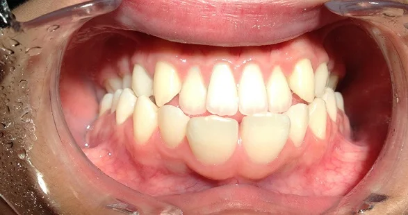 Worst Dentist Appointment Ever!