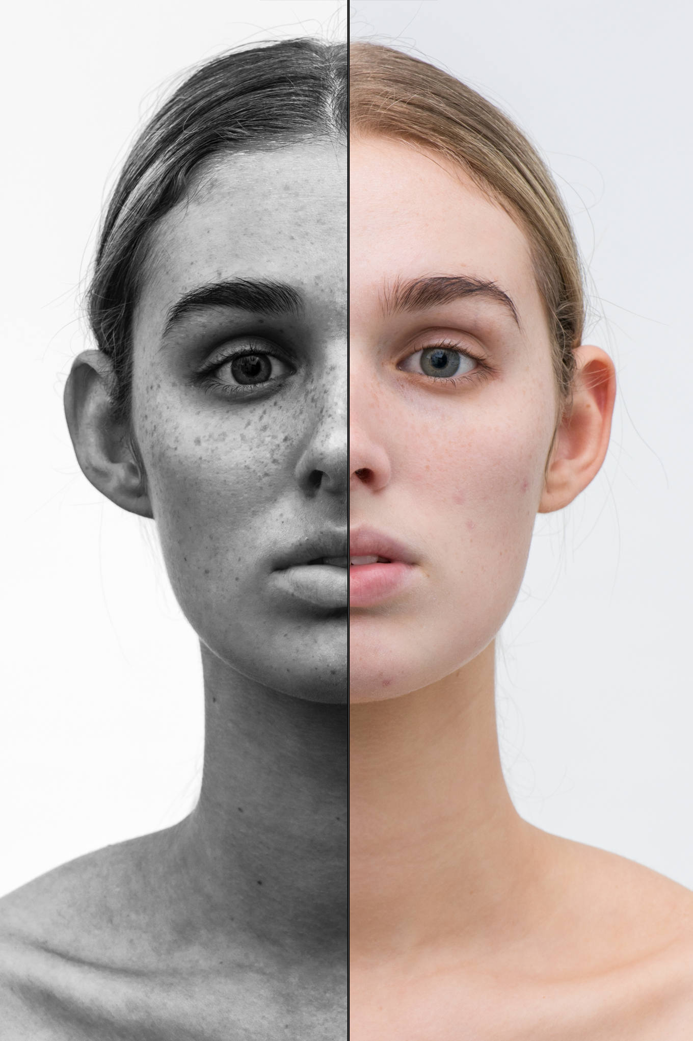 Melanin filter shows sun damage to the skin.