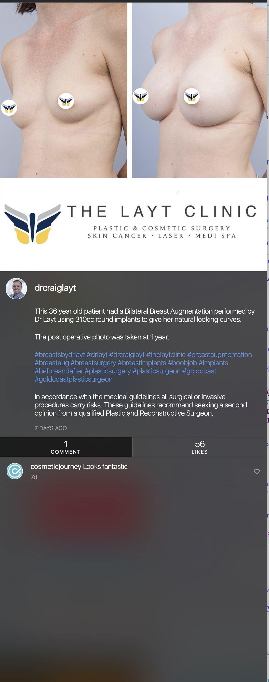 Screenshot 2018-02-22 09.52.13.png