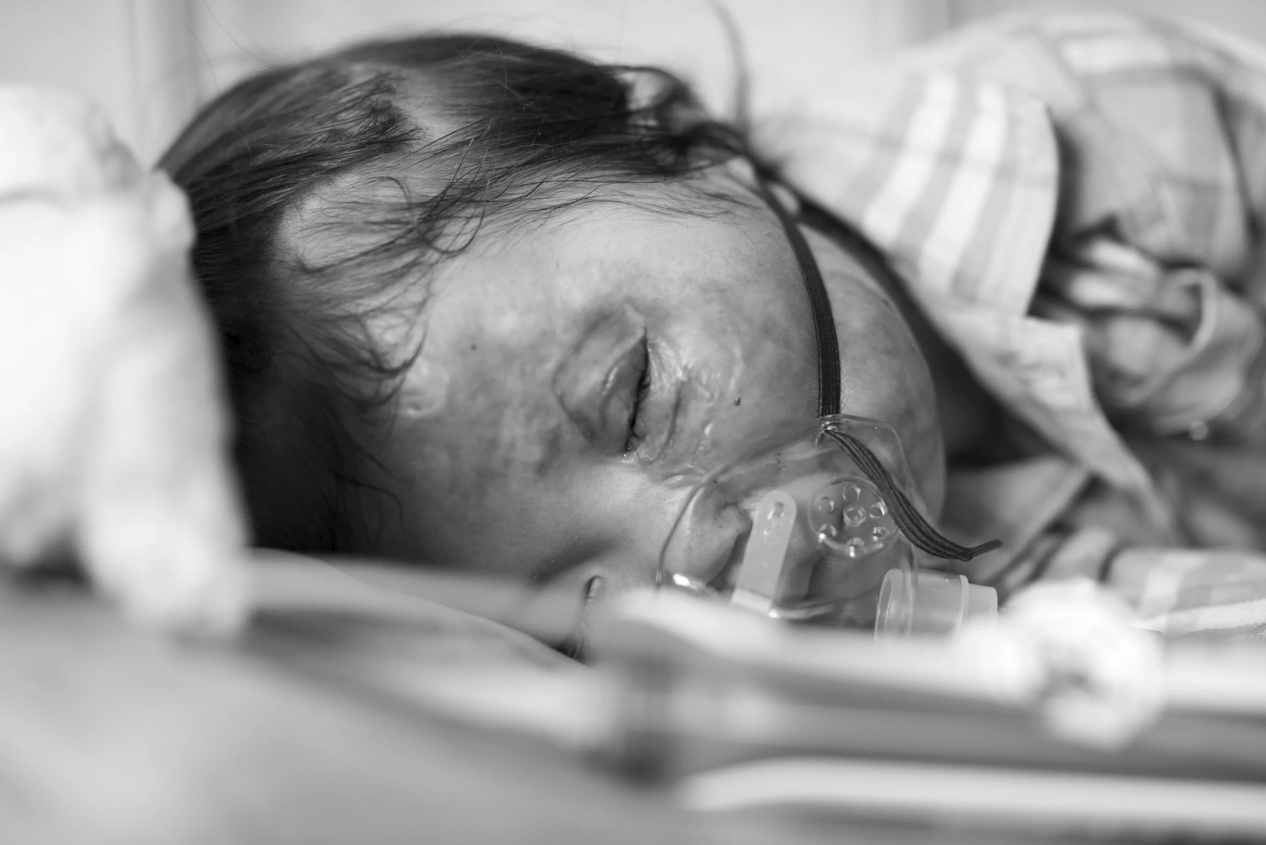 20170816- interplast mongolia Woodrow Wilson 101.jpg