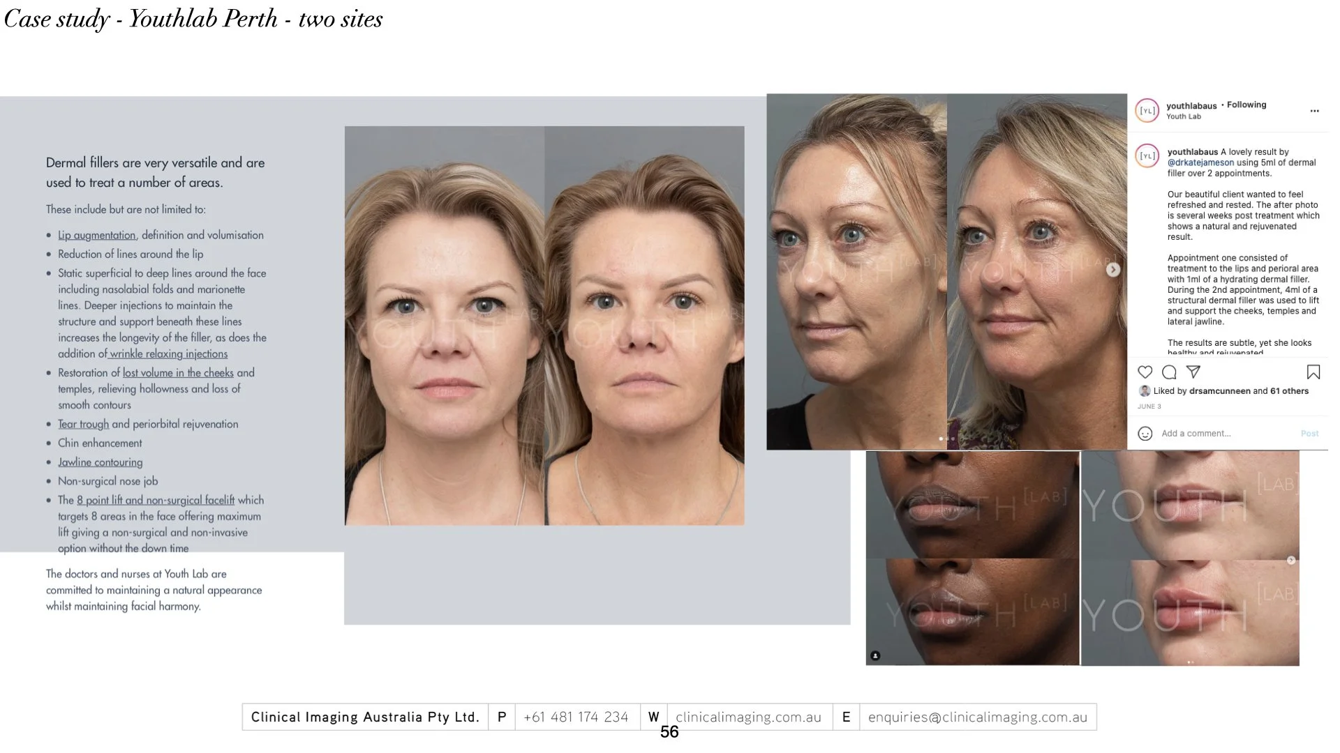 ‎2023 - Master deck_for papers_consult.‎056.jpeg