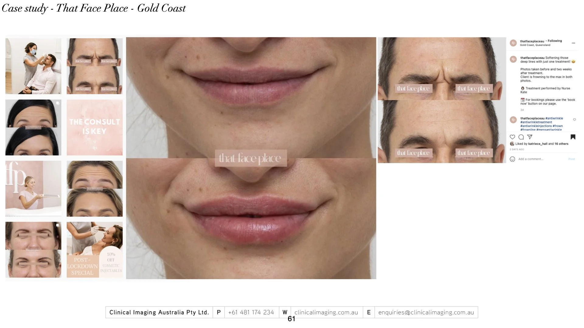 ‎2023 - Master deck_for papers_consult.‎061.jpeg