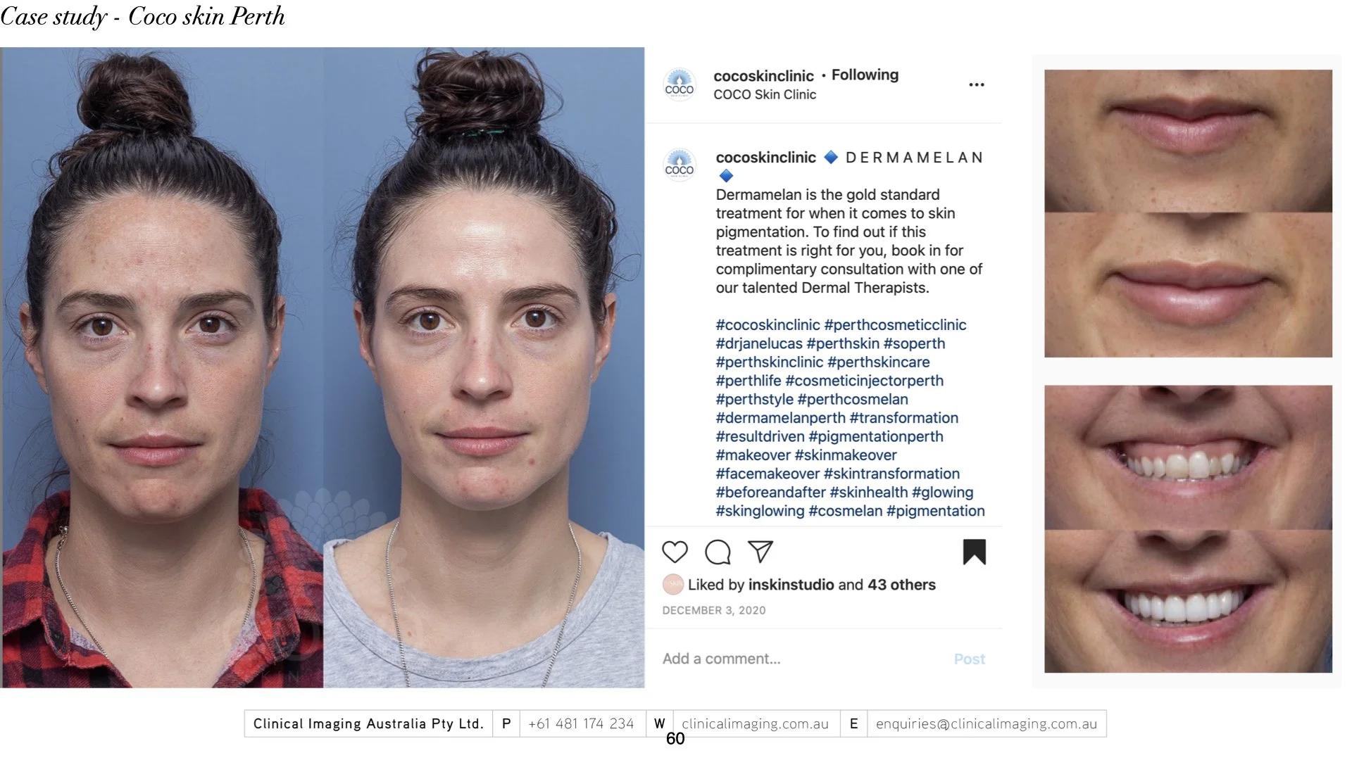 ‎2023 - Master deck_for papers_consult.‎060.jpeg