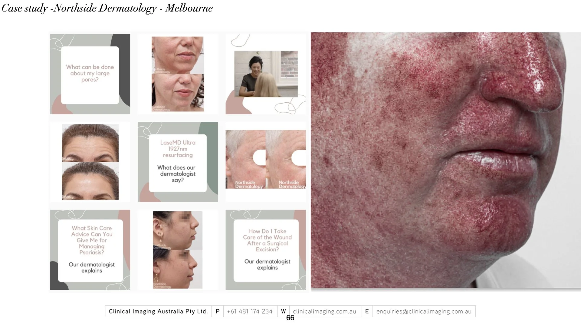 ‎2023 - Master deck_for papers_consult.‎066.jpeg