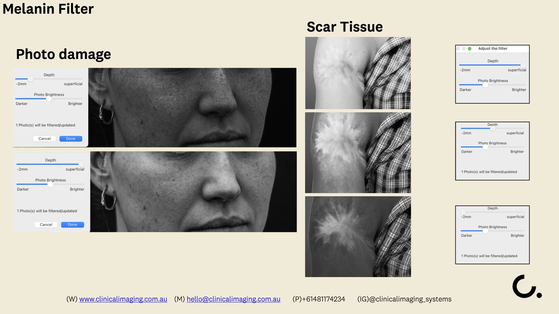 CLINICAL IMAGING SETUP -  Filters explainer .007.jpeg