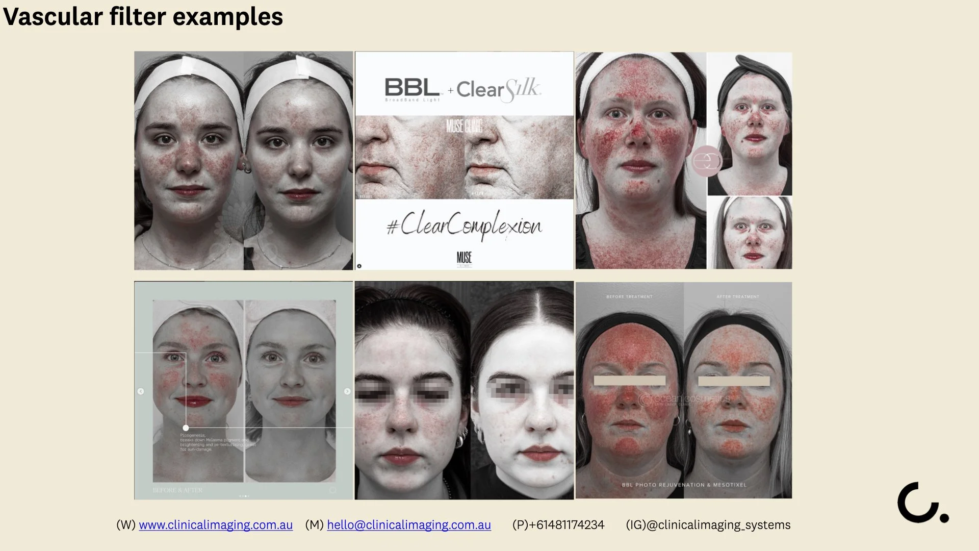 CLINICAL IMAGING SETUP -  Filters explainer .005.jpeg