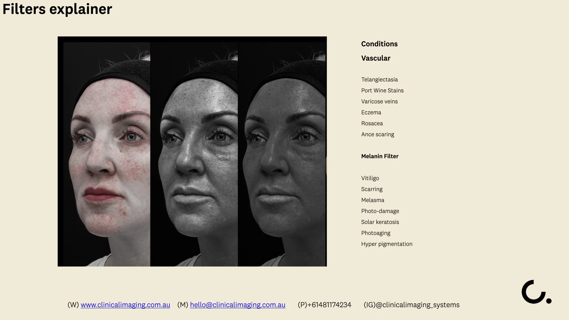 CLINICAL IMAGING SETUP -  Filters explainer .003.jpeg