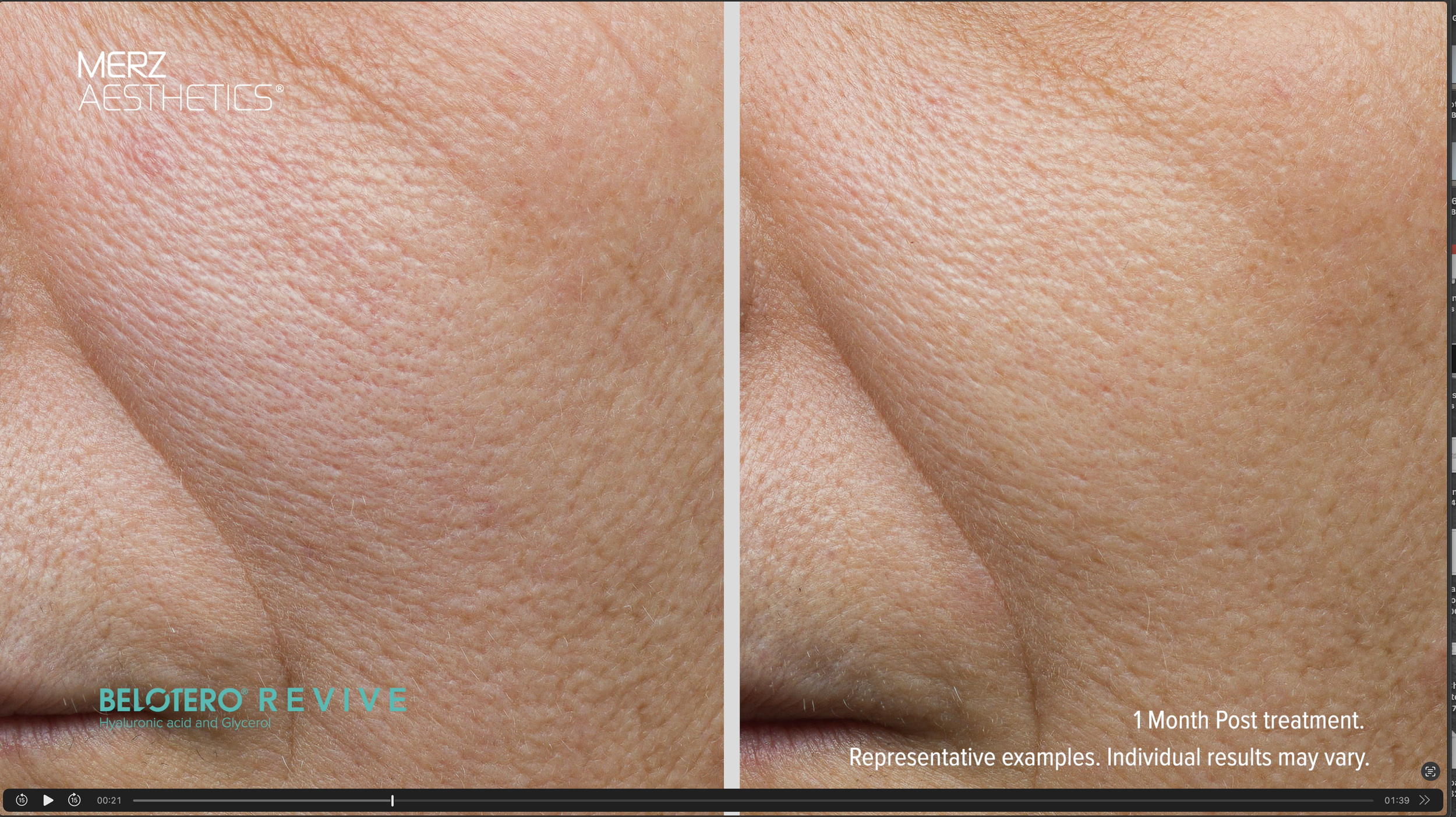 How to communicate S4 medicine on Instagram.