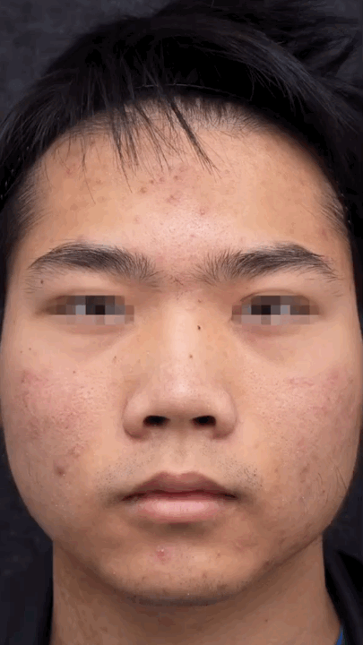 Why you’re struggling with capturing skin details. 