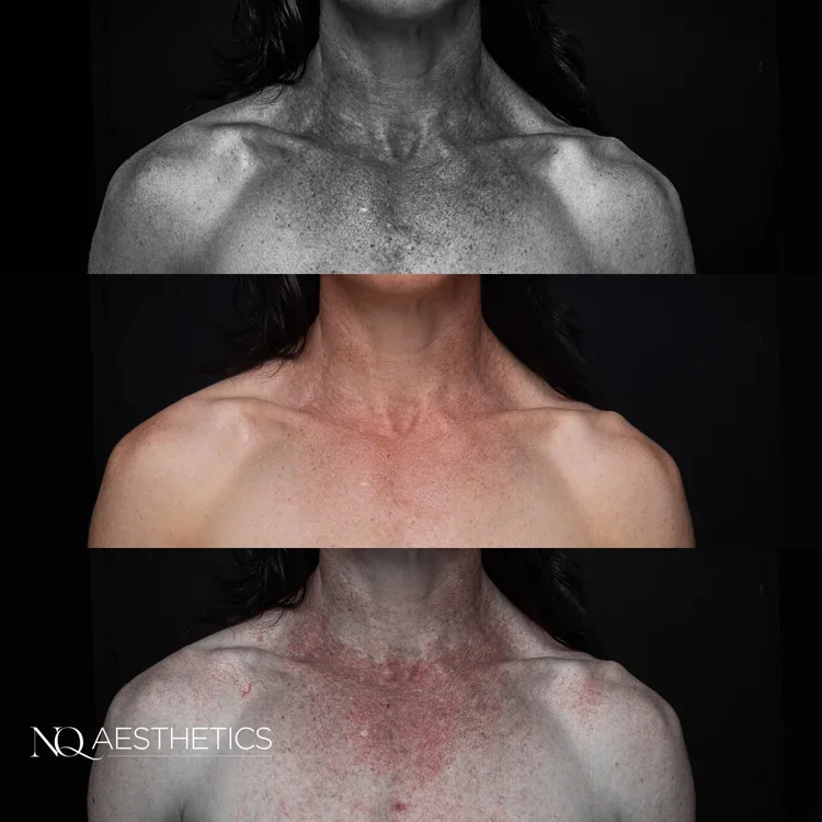 Clinical Imaging Filters - Updates! 