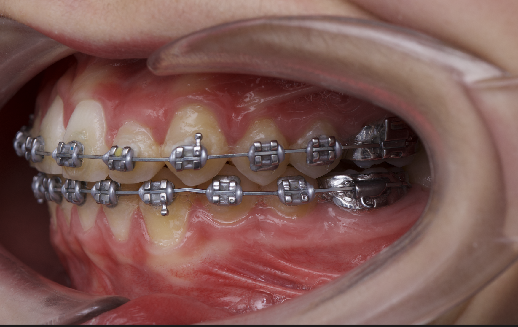 Dental photography introduction course. 