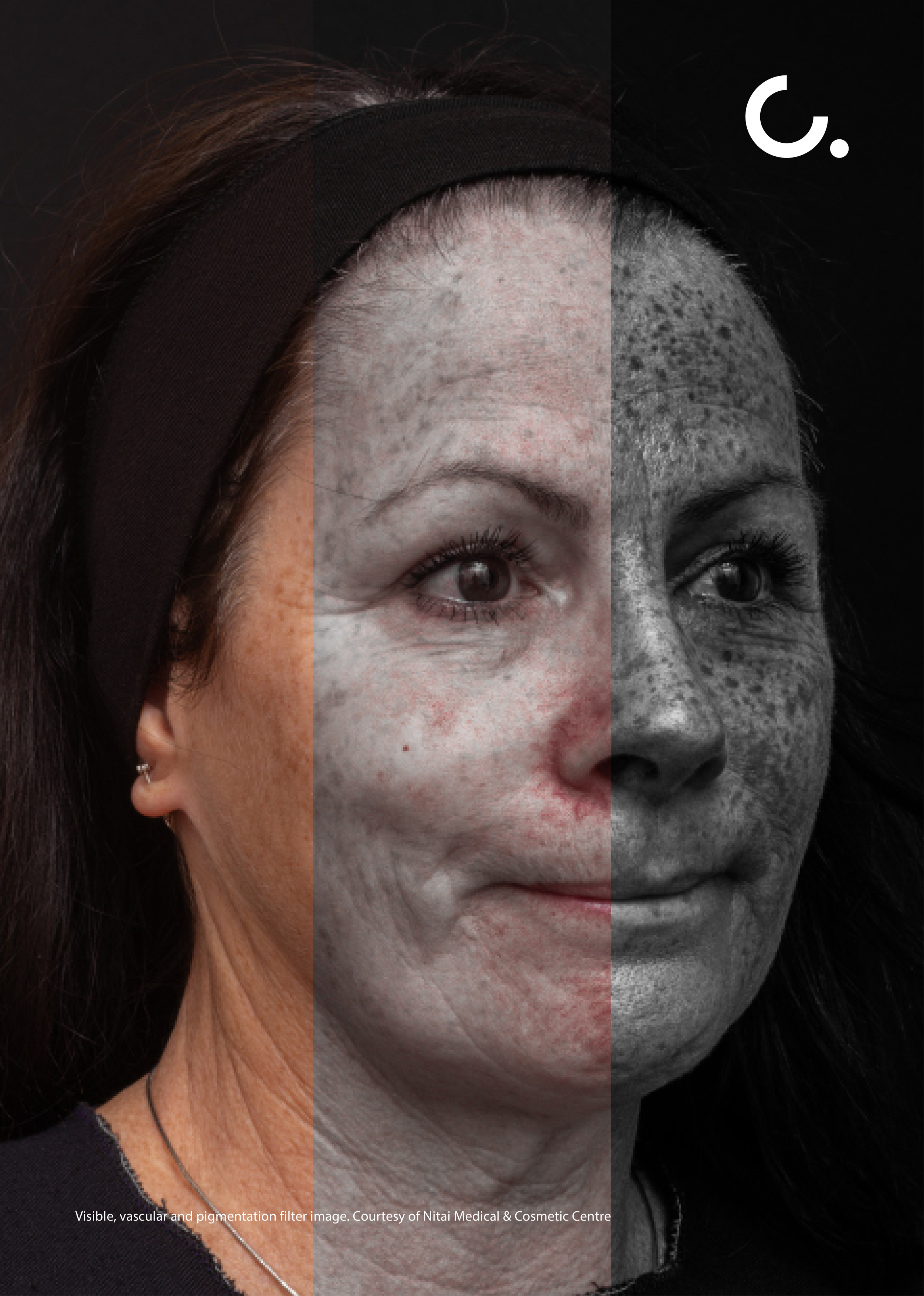 Clinical Imaging A1 Panels V1 FA filters.png