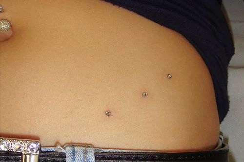DERMAL_9.jpg