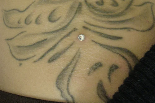 DERMAL_22.jpg