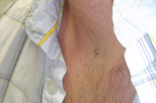 DERMAL_23.jpg