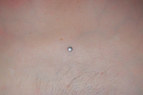 DERMAL_25.jpg